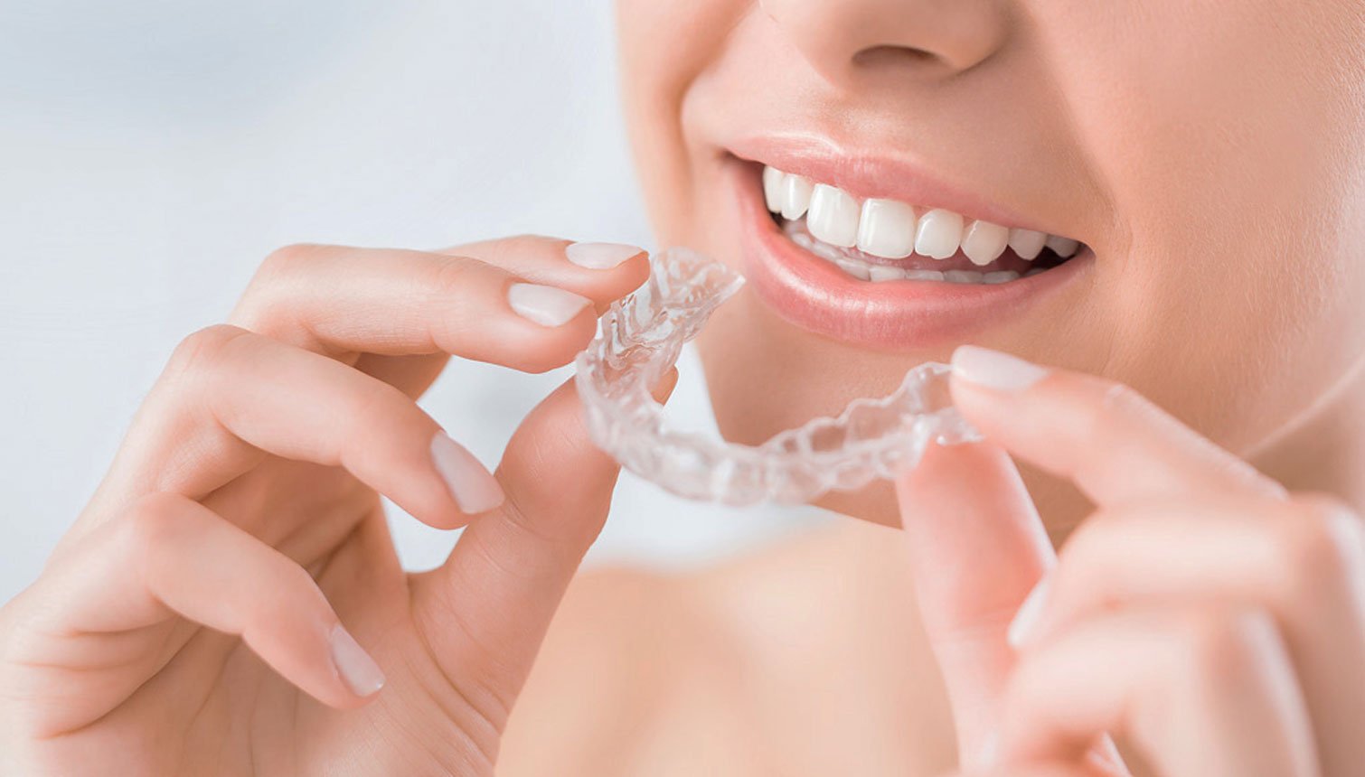 Invisalign